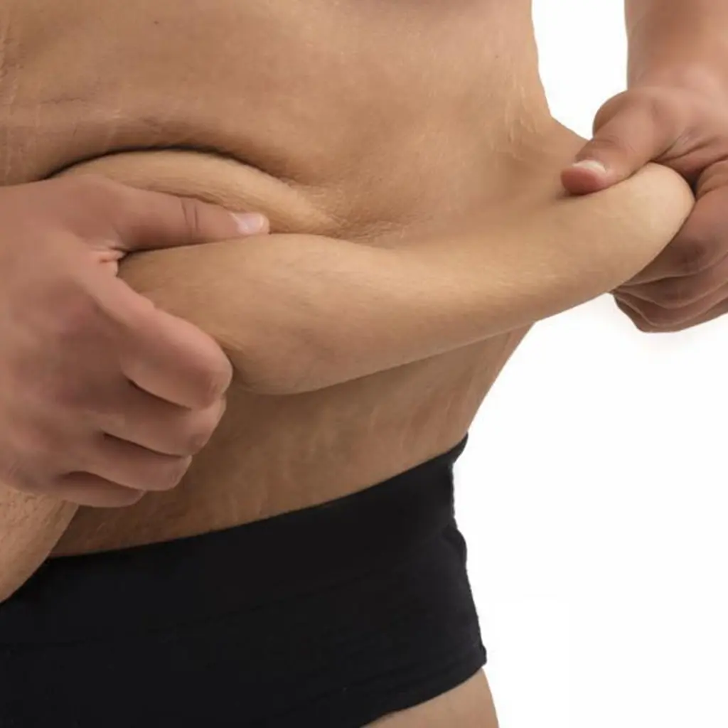 Bariatric operations