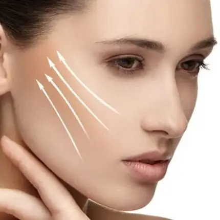 Face Lift